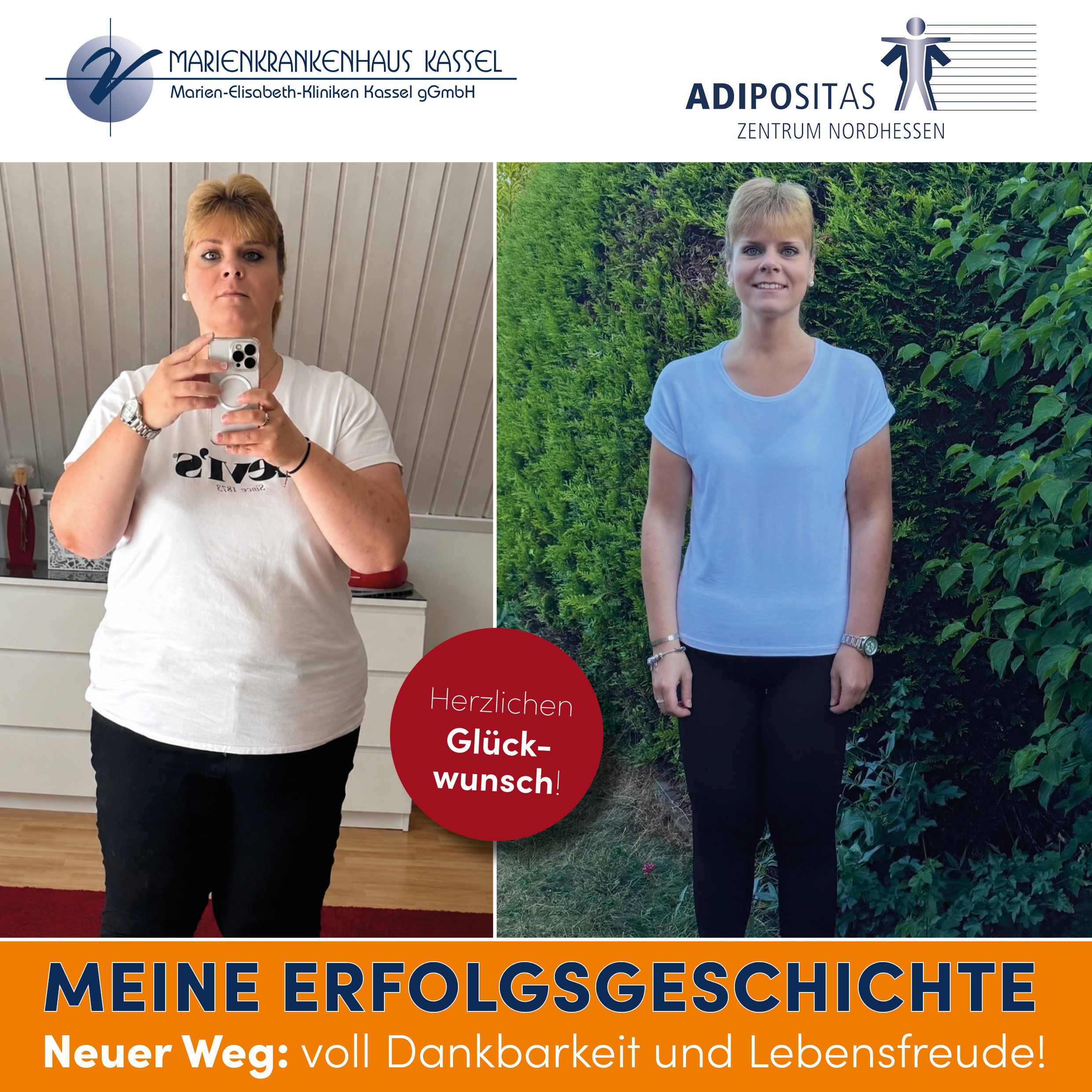 vorher nachher 2026